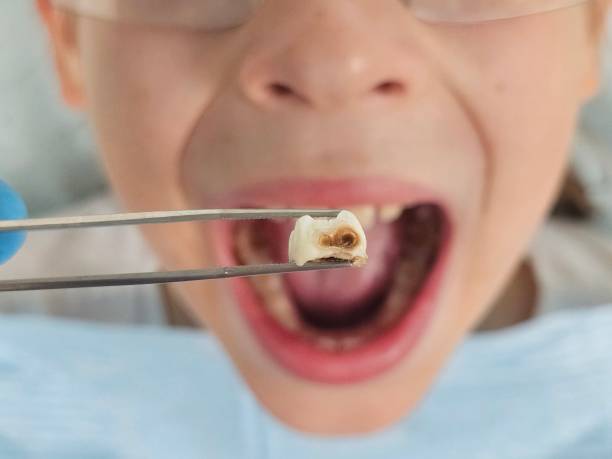 Best Pediatric Emergency Dentist in Lexington, TX